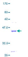 Human CST9L / Cystatin 9-Like Protein (Recombinant GST)