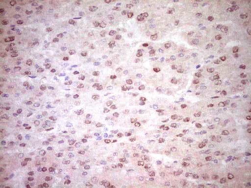 NR3C1/Glucocorticoid Receptor Antibody (aa1-265, clone OTI4C9)