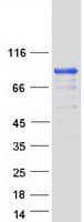 Human Band 4.1 / EPB41 Protein (Recombinant Myc-DDK (Flag))