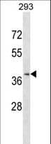 CCRL2 Antibody (aa206-234)