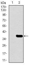 SLC27A5 / BACS Antibody (Amino Acid: 508-570, clone 4B11C10)