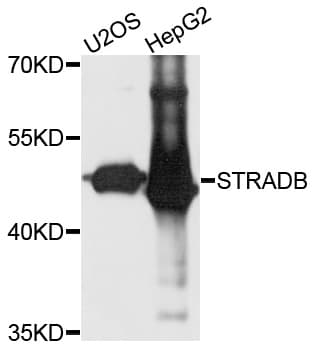 STRADB / ALS2CR2 Antibody