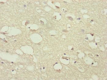 PPP2R3C Antibody