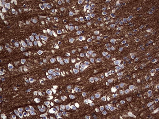 Monoclonal Mouse anti-Human NCAM / CD56 Antibody (clone OTI2A2, aa20-718, IHC)