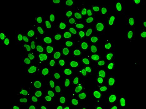 Polyclonal Rabbit anti-Human QKI Antibody (IHC, IF, WB)