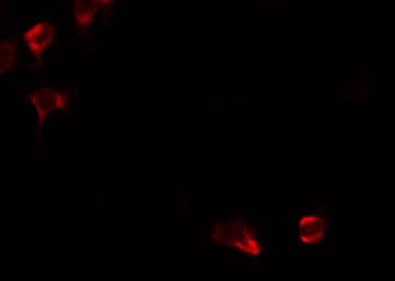Polyclonal Rabbit anti-Human ARG2 / Arginase 2 Antibody (IF, WB)