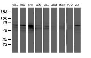 FMR1 / FMRP Antibody (clone OTI2C3)