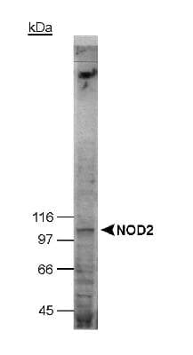 NOD2 / CARD15 Antibody (aa28-301, clone 2D9)