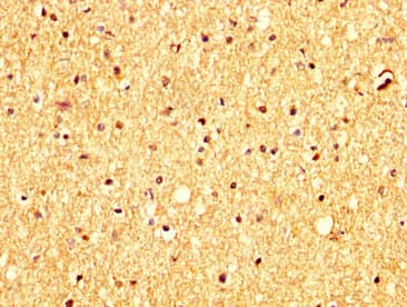 Polyclonal Rabbit anti-Human RHCG Antibody (IHC, WB)