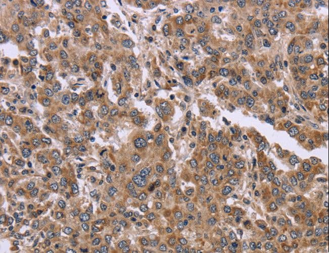 FAM3B Antibody