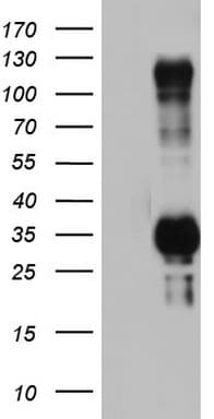 TRIM24 / TIF1 Antibody (aa706-1016, clone OTI3A8)
