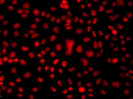 Polyclonal Rabbit anti-Human HNRPA1 / HnRNP A1 Antibody (IHC, IF, WB)