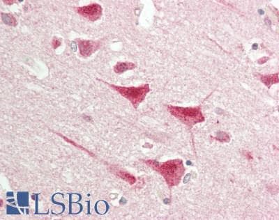 IHC-plus™ TLE1 / TLE 1 Antibody (aa175-225)