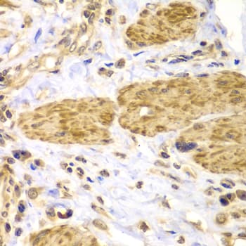 FAK / Focal Adhesion Kinase Antibody