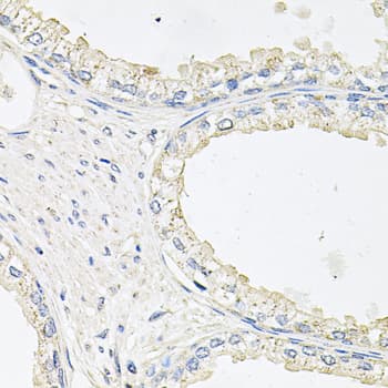 Polyclonal Rabbit anti-Human EPOR / EPO Receptor Antibody (IHC, WB)