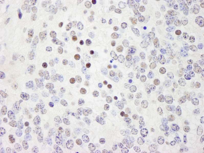 WRNIP1 / WHIP Antibody (aa400-450)