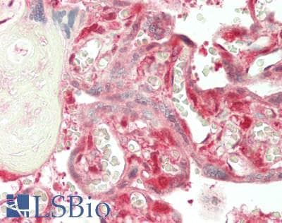 IHC-plus™ CSTB / Cystatin B / Stefin B Antibody