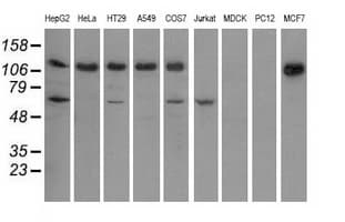Monoclonal Mouse anti-Human IGF2BP2 Antibody (clone OTI4F7, IF, WB)