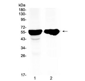 CYP2D6 Antibody