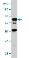 PathPlus™ CD71 / Transferrin Receptor Antibody (clone 1E6)