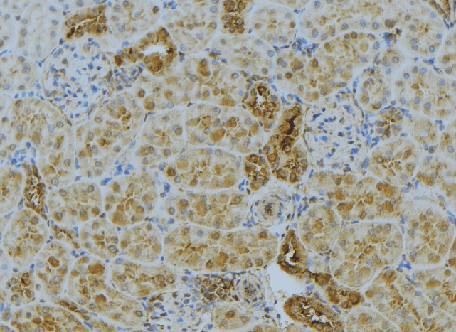 ACSL4 / FACL4 Antibody