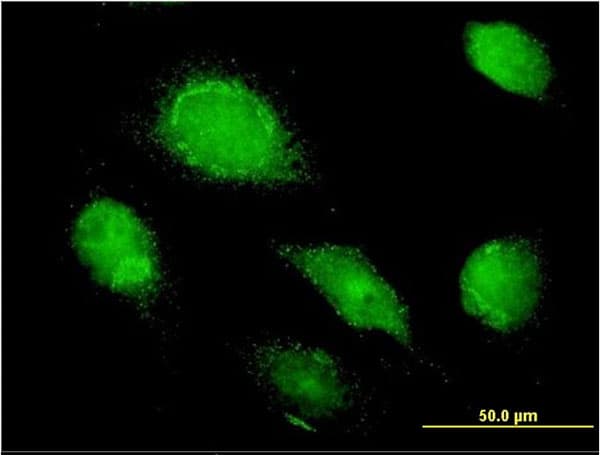 Monoclonal Mouse anti-Human AMBP Antibody (clone 3F1, IF, WB)