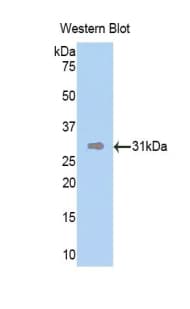 DMD / Dystrophin Antibody (aa3059-3314)
