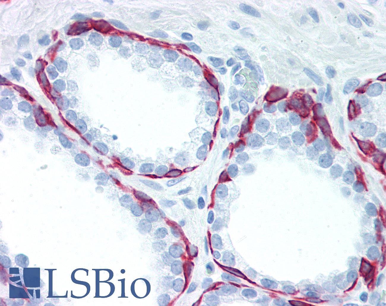 IHC-plus™ Cytokeratin 5+6 Antibody (clone ABT-CK5/6)