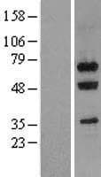 GNL3 / NS / Nucleostemin Protein (Over-Expression Lysate Myc-DDK (Flag))