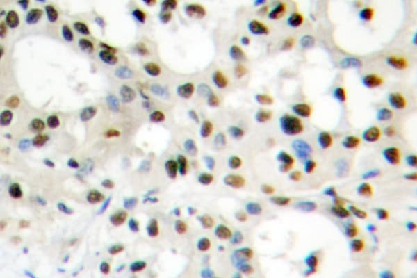 Polyclonal Rabbit anti-Human HNRPA1 / HnRNP A1 Antibody (Glu85, IHC, IF, WB)
