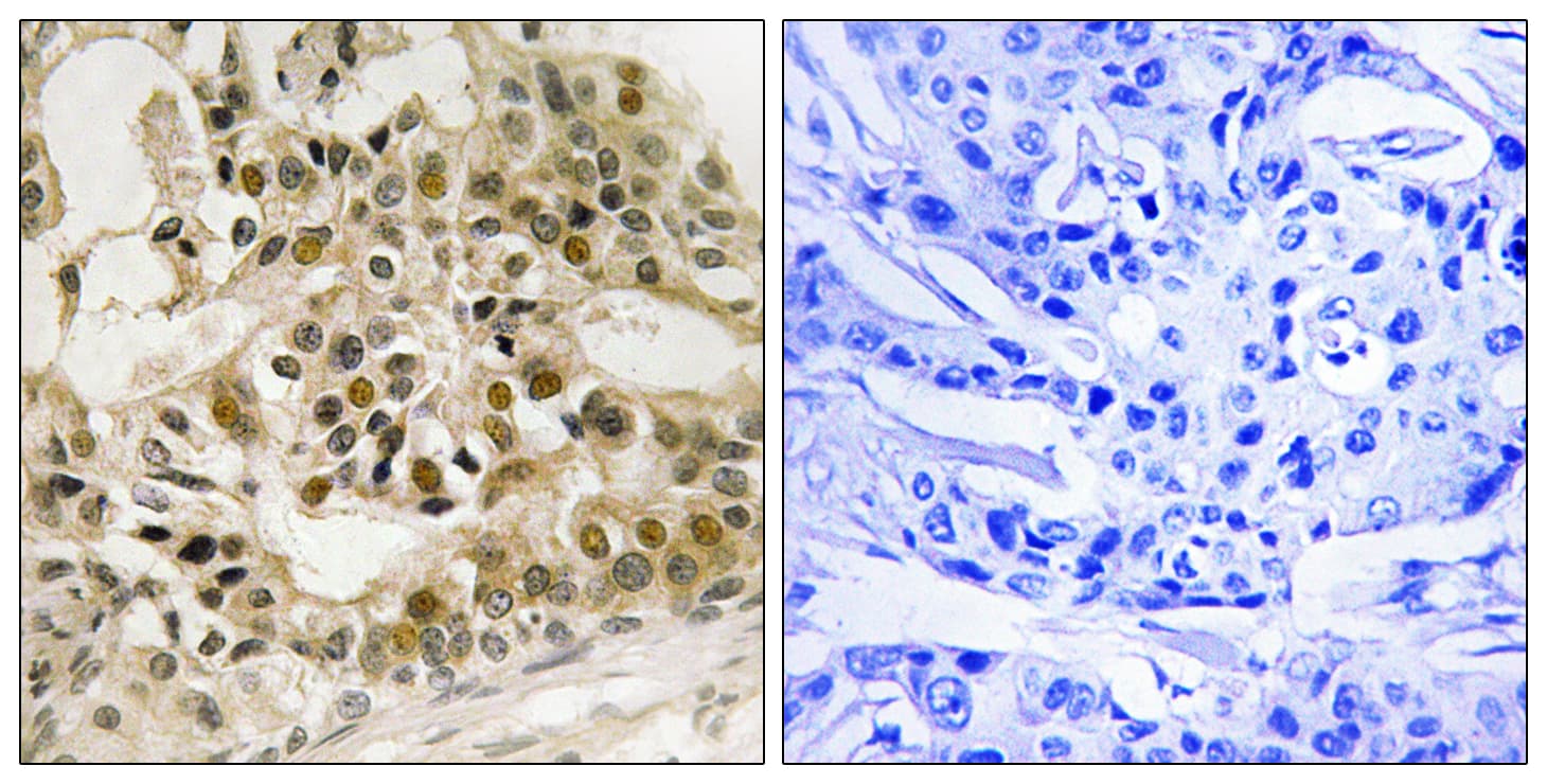 MYB / c-Myb Antibody (phospho-Ser532)