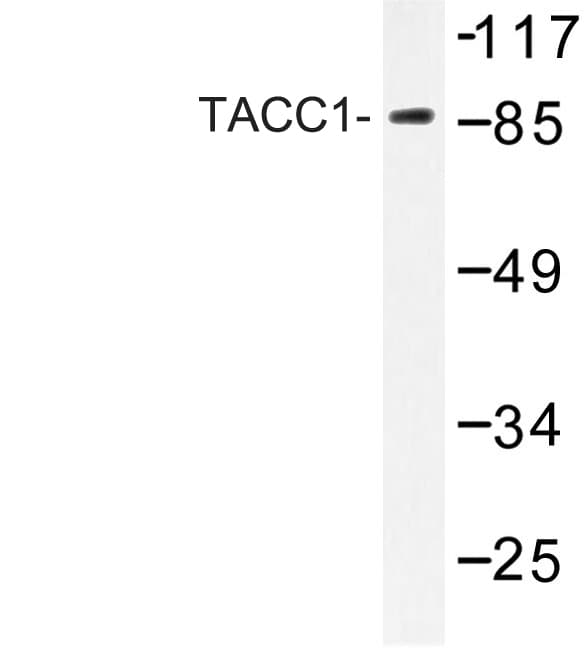 TACC1 Antibody (Glu41)