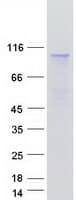 Human CFB / Complement Factor B Protein (Recombinant Myc-DDK (Flag))