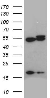 ACTR3 Antibody (aa2-418, clone OTI5G4)