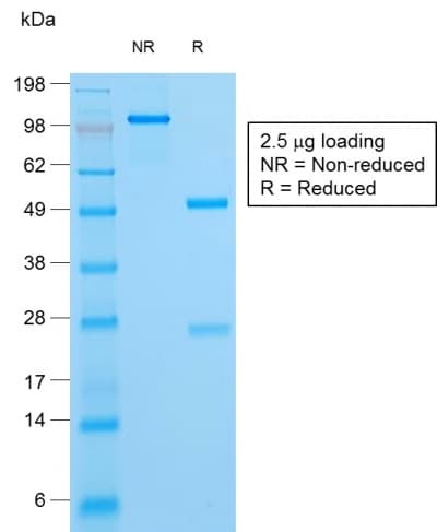 HSV-1 / Herpes Simplex Virus 1 Antibody (clone HSV1/1934, Azide-free, Carrier-free)