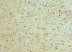 BCL11A Antibody (aa1-230)