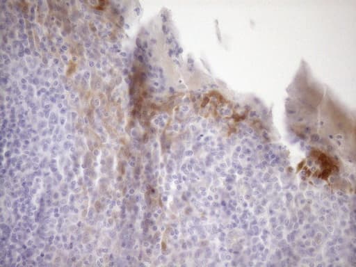 p16INK4a / CDKN2A Antibody (clone OTI1H3)