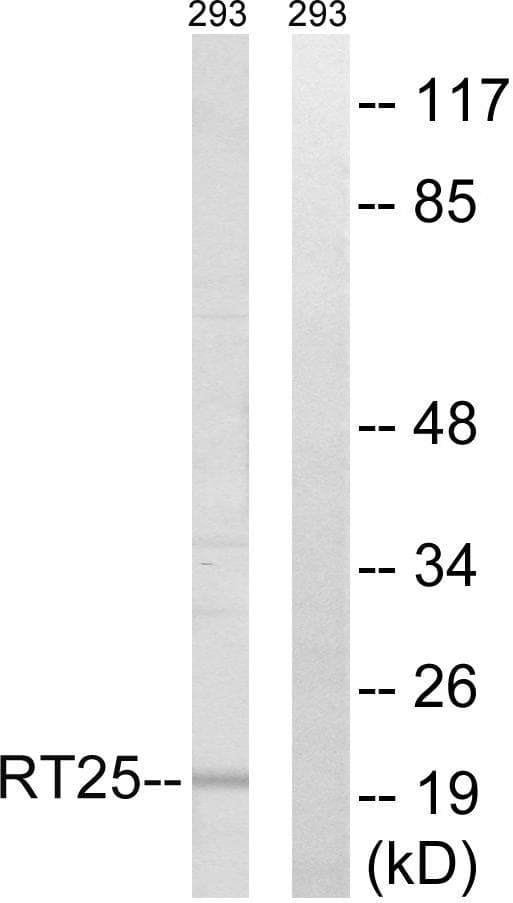Polyclonal Rabbit anti-Human MRPS25 Antibody (WB)