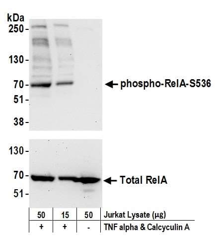 Polyclonal Rabbit anti-Human RELA / NFKB p65 Antibody (phospho-Ser536, IHC, WB)