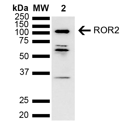 ROR2 Antibody (APC)