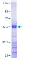 Human RPL17 / Ribosomal Protein L17 (Recombinant GST)