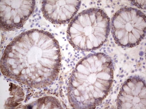 Monoclonal Mouse anti-Human Acidic Cytokeratin AE1 Antibody (clone AE1, IHC)