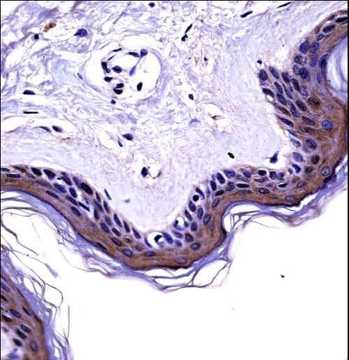 GRB4 / NCK2 Antibody (aa63-92)