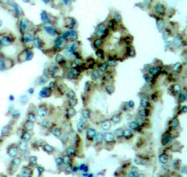 PRKCB / PKC-Beta Antibody (phospho-Thr641)