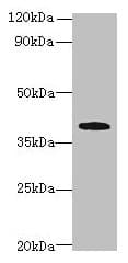 Polyclonal Rabbit anti-Human PRPSAP1 Antibody (WB)