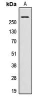 LBC / AKAP13 Antibody (Internal)