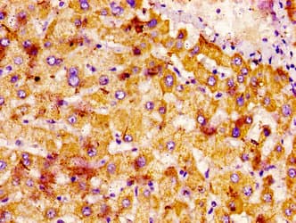 NTN1 / Netrin 1 Antibody
