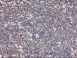 EXOSC7 Antibody (clone OTI1G8)