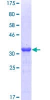 Human NPC / NPC1 Protein (Recombinant GST, N-terminus)