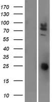 CEACAM20 Protein (Over-Expression Lysate Myc-DDK (Flag))
